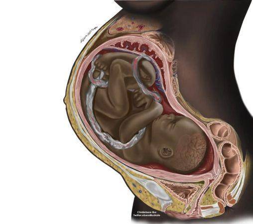 Nigerian Student Changes The Game When Illustration Of A Black Woman’s Womb Goes Viral