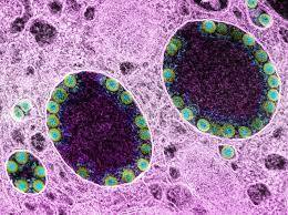 Covid BA.2 Omicron Variant Likely Now Accounts For Majority Of New Cases In Los Angeles