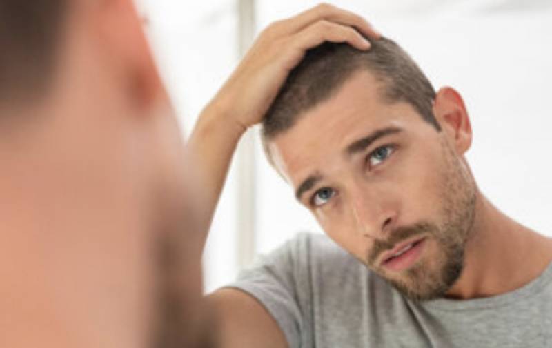 Man Cracks The Code To Avoiding Hair Loss… & You Can Do It Too