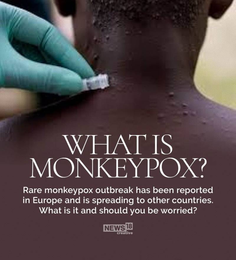 Monkeypox: What is it, and Why is it Spreading Now?