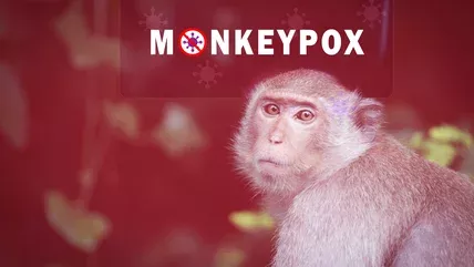 Did Smallpox Really Come From Monkeys?