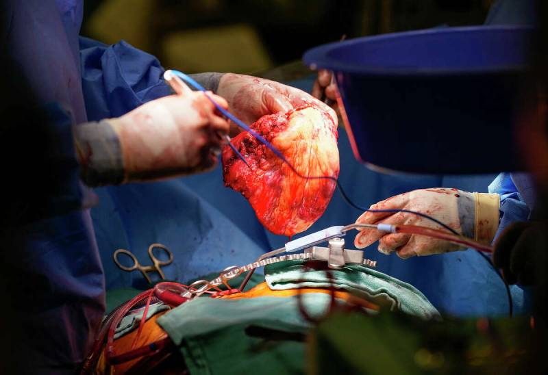 Doctor Breaks Down a Heart Transplant | WIRED