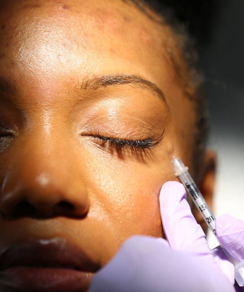 I Got Botox Injections for the First Time | Macro Beauty