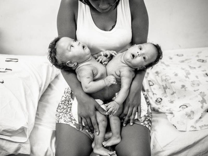 The Craziest Surgeries That You Have Ever Heard Of, And Some You Haven’t