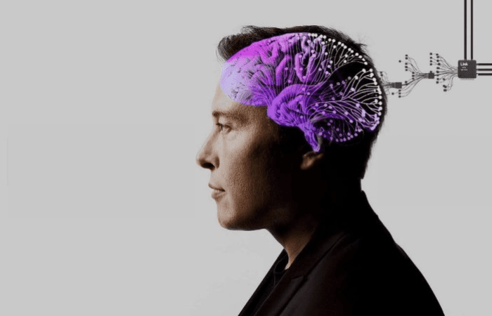 Alphabet and Microsoft Earnings, Neuralink's Brain Implant