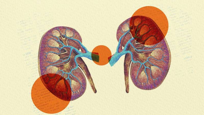 Kidney Disease