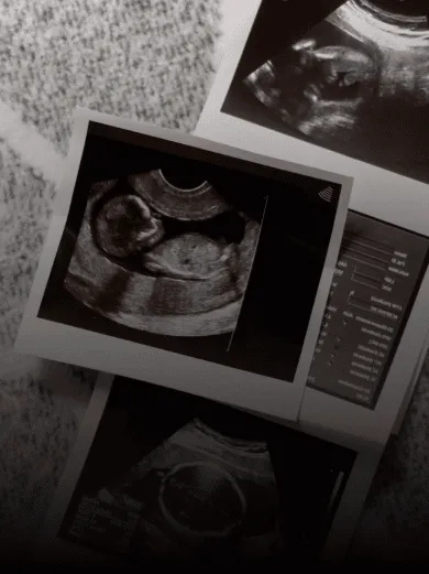 Eggs Cost More Than Sperm in Kenya's Clinics