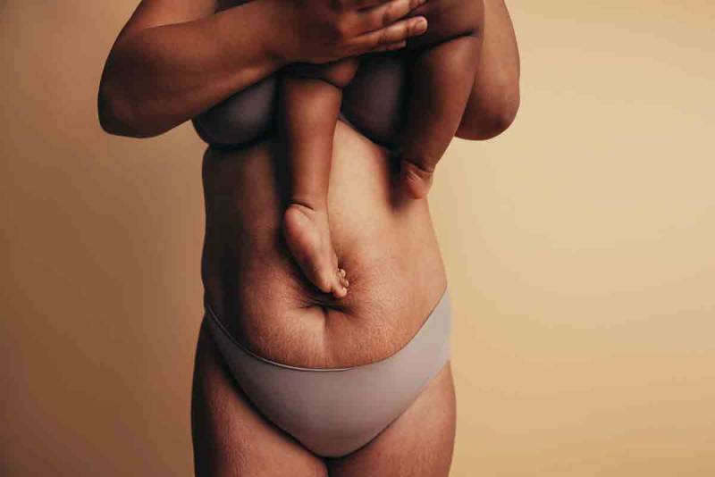 Dr. William of Dr William Miami - Tummy Tuck