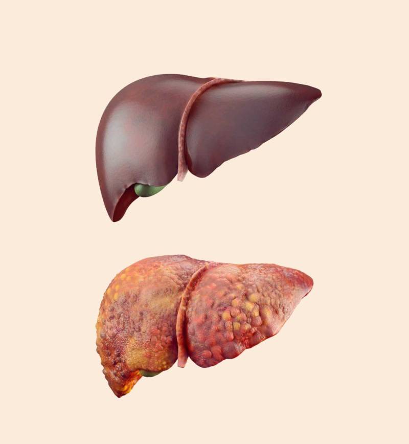 This disease is more dangerous than HIV!