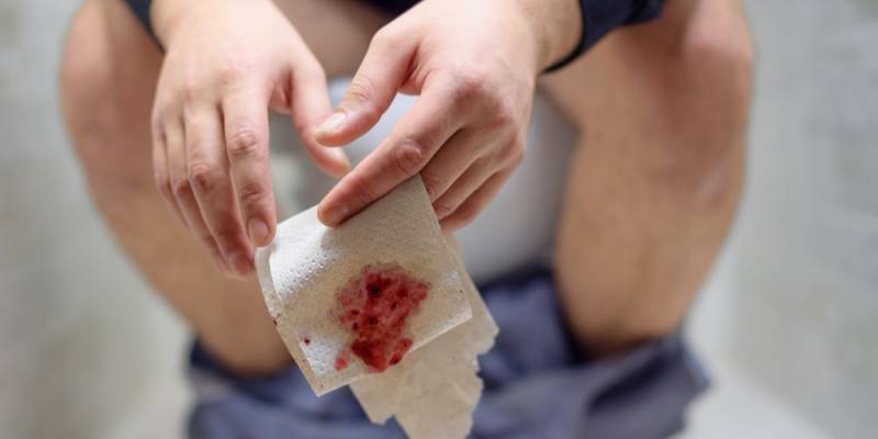 Blood in Your Stool? Read This