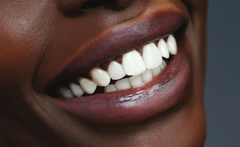 How to make your teeth whiter!