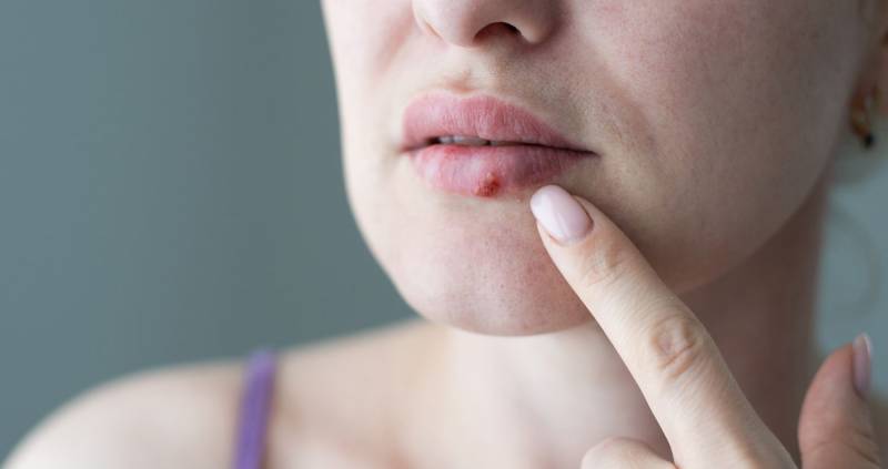 Is Staphylococcus Aureus an STI?